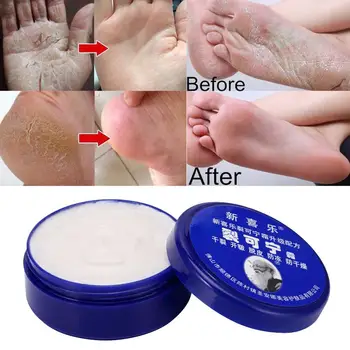 33/55gPowerful Tradițională Chineză Anti-Uscare Crack Crema de Picioare Călcâi Crăpat Crema de Reparații Îndepărtarea Pielii Moarte de Mână de Îngrijire de Picioare